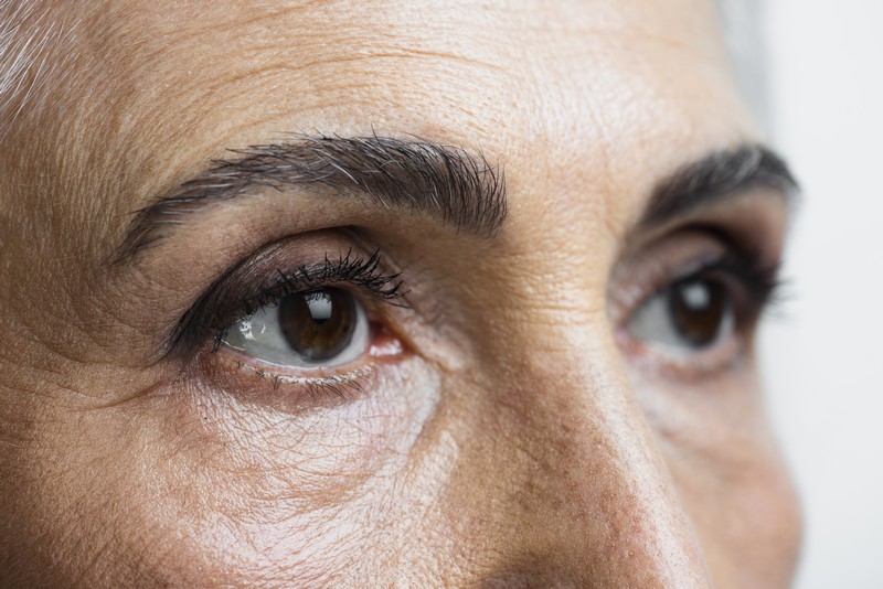 Szemkörnyék és szájmaszk